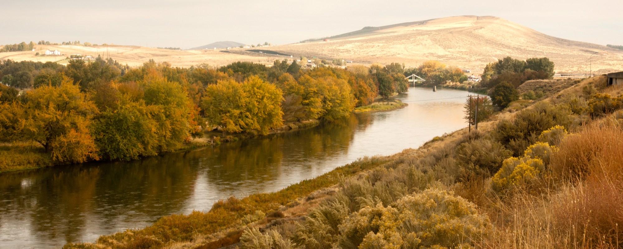 Endodontics Yakima WA, Endodontist